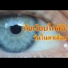 โกจิเบอร์รี่ ช่วยป้องกันสายตาเสื่อม วุ้นในตาเสื่อม