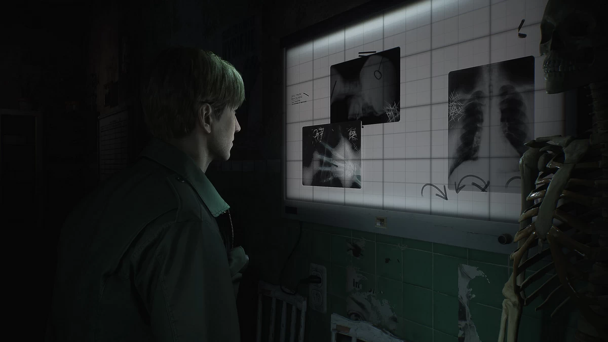 PS5- Silent Hill 2